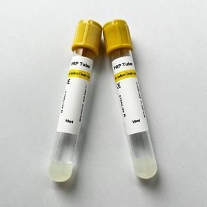 Siny High Quality Medical Consumables Ha & Sodium Citrate & Gel Disposable Vacuum Blood Collection Prp Tube