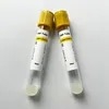 Siny High Quality Medical Consumables Ha & Sodium Citrate & Gel Disposable Vacuum Blood Collection Prp Tube