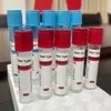 Siny High Quality Medical Consumables Ha & Sodium Citrate & Gel Disposable Vacuum Blood Collection Prp Tube