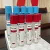 Siny Manufacturer Disposable Vacuum Blood Collection Tube Calcium Chloride Prp Tube with ISO