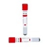 Siny Medical Disposable Blood Collection Prp Tube Extraction of Platelet Rich Plasma