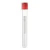 Siny Medical Injectable Platelet-Rich Fibrin I Prf Tube